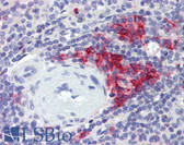 Anti-CD38 Antibody (clone 6E12D) IHC-plus LS-B3888