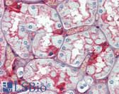 Anti-ALB / Serum Albumin Antibody (clone 2H3D1;8F6F9) IHC-plus LS-B3900