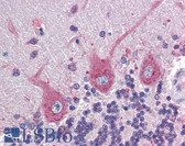 Anti-EPHB4 / EPH Receptor B4 Antibody (Extracellular, clone 5B5) IHC-plus LS-B3905