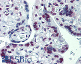 Anti-CUL9 / Cullin 9 Antibody (clone PO69) IHC-plus LS-B3911