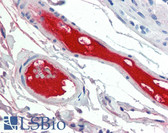 Anti-Complement C4d Antibody (Internal, clone A24-T) IHC-plus LS-B3921