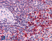 Anti-TRXR1 / TXNRD1 Antibody (C-Terminus) IHC-plus LS-B3926