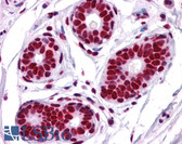 Anti-TRIM28 / KAP1 Antibody (C-Terminus) IHC-plus LS-B3928