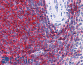 Anti-SH3BP1 Antibody (C-Terminus) IHC-plus LS-B3930