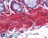 Anti-ACTA2 / Smooth Muscle Actin Antibody (N-Terminus) IHC-plus LS-B3933