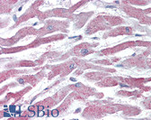 Anti-AKT3 Antibody (Internal) IHC-plus LS-B3935