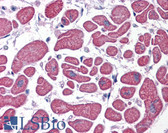 Anti-PDE4D Antibody (C-Terminus) IHC-plus LS-B3940