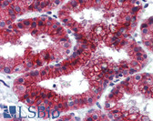 Anti-KDM4C / JMJD2C Antibody (C-Terminus) IHC-plus LS-B3975