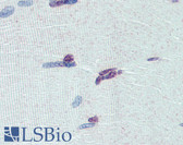 Anti-PRDM9 Antibody (aa431-480) IHC-plus LS-B3982