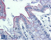 Anti-ABHD5 Antibody (C-Terminus) IHC-plus LS-B3990