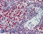 Anti-FCHO1 Antibody (aa468-517) IHC-plus LS-B3998