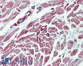 Anti-PHACTR1 Antibody (aa468-517) IHC-plus LS-B4000