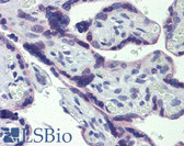 Anti-STAT5B Antibody (N-Terminus) IHC-plus LS-B4002