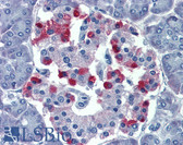 Anti-GNAS Antibody (aa36-85) IHC-plus LS-B4007