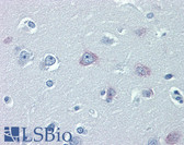 Anti-TRPM2 Antibody (aa431-480) IHC-plus LS-B4013