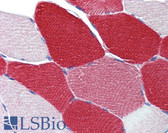 Anti-MYL6 Antibody (aa72-121) IHC-plus LS-B4025