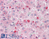 Anti-SET / TAF-I Antibody (N-Terminus) IHC-plus LS-B4032