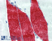 Anti-TNNI / Troponin I Skeletal Antibody (clone 12F10) IHC-plus LS-B4037