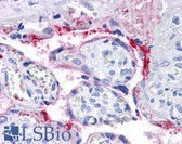 Anti-ITGB3 / Integrin Beta 3 / CD61 Antibody (clone VI-PL2) IHC-plus LS-B4046