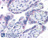 Anti-SDC1 / Syndecan 1 / CD138 Antibody (clone DL-101) IHC-plus LS-B4051
