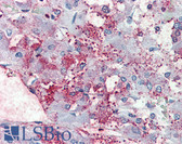 Anti-THEM6 / C8orf55 Antibody (Internal) IHC-plus LS-A8239