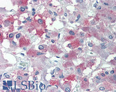 Anti-THEM6 / C8orf55 Antibody (Internal) IHC-plus LS-A8243