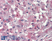 Anti-THEM6 / C8orf55 Antibody (Internal) IHC-plus LS-A8245