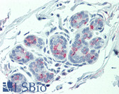 Anti-ITGA6/Integrin Alpha 6/CD49f Antibody (Internal) IHC-plus LS-A8768