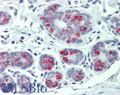 Anti-ITGA6/Integrin Alpha 6/CD49f Antibody (Internal) IHC-plus LS-A8769
