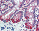 Anti-ESYT1 Antibody (Internal) IHC-plus LS-A9546