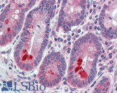 Anti-ESYT1 Antibody (Internal) IHC-plus LS-A9547