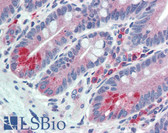 Anti-ESYT1 Antibody (Internal) IHC-plus LS-A9549