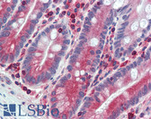 Anti-ESYT1 Antibody (C-Terminus) IHC-plus LS-A9554