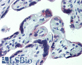 Anti-CXCR6 Antibody IHC-plus LS-B4083
