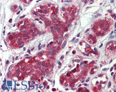 Anti-FANCC Antibody IHC-plus LS-B4086