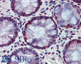 Anti-HDAC1 Antibody IHC-plus LS-B4088