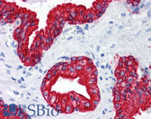 Anti-Pan Cytokeratin Antibody IHC-plus LS-B4089