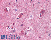 Anti-PAWR Antibody (clone 3G9H7,4H12E9) IHC-plus LS-B4094