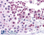 Anti-MDM4 / MDMX Antibody (clone 2D10F4) IHC-plus LS-B4097
