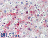 Anti-MTHFD1 Antibody (Internal) IHC-plus LS-B4110