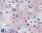 Anti-ABCB4 / MDR3 Antibody (N-Terminus) IHC-plus LS-B4112