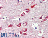 Anti-GABRA3 Antibody (C-Terminus) IHC-plus LS-B4146