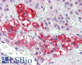 Anti-FOXO1 / FKHR Antibody (C-Terminus) IHC-plus LS-B4151