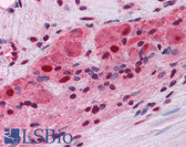 Anti-MUM1 Antibody (clone 4G10) IHC-plus LS-B4162