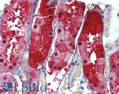 Anti-JPH4 Antibody (Internal) IHC-plus LS-B4166
