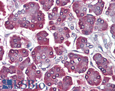 Anti-PDCD5 Antibody (C-Terminus) IHC-plus LS-B4167