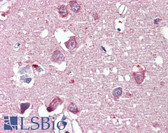 Anti-RTN4 / Nogo Antibody (Internal) IHC-plus LS-B4168
