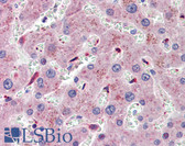 Anti-SOS1 / HGF Antibody (Internal) IHC-plus LS-B4169