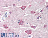 Anti-RASSF1 / RASSF1A Antibody (Internal) IHC-plus LS-B4170