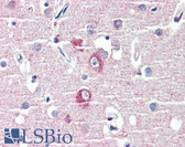 Anti-DLGAP1 Antibody (Internal) IHC-plus LS-B4171
